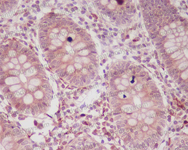 Anti-ARPC5/p16 ARC Antibody (R1B28)