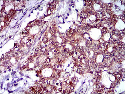Anti-FLIP/CFLAR Antibody (R2U73)