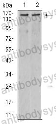 Anti-KDM6A Antibody (R2U77)