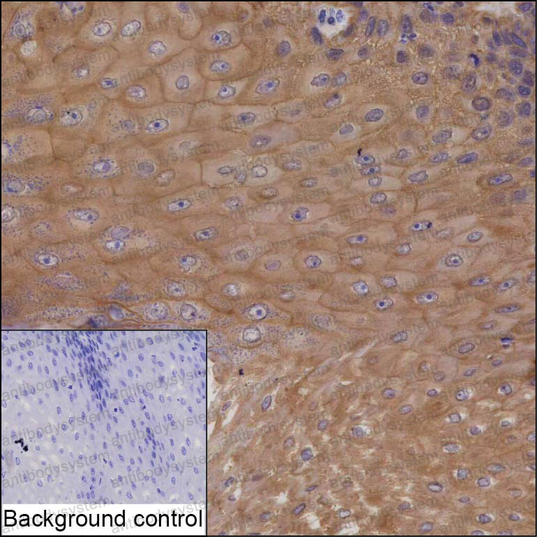 Anti-SPINT1 Antibody (R2U82)