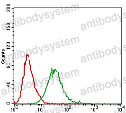 Anti-DAPK3 Antibody (R2U84)