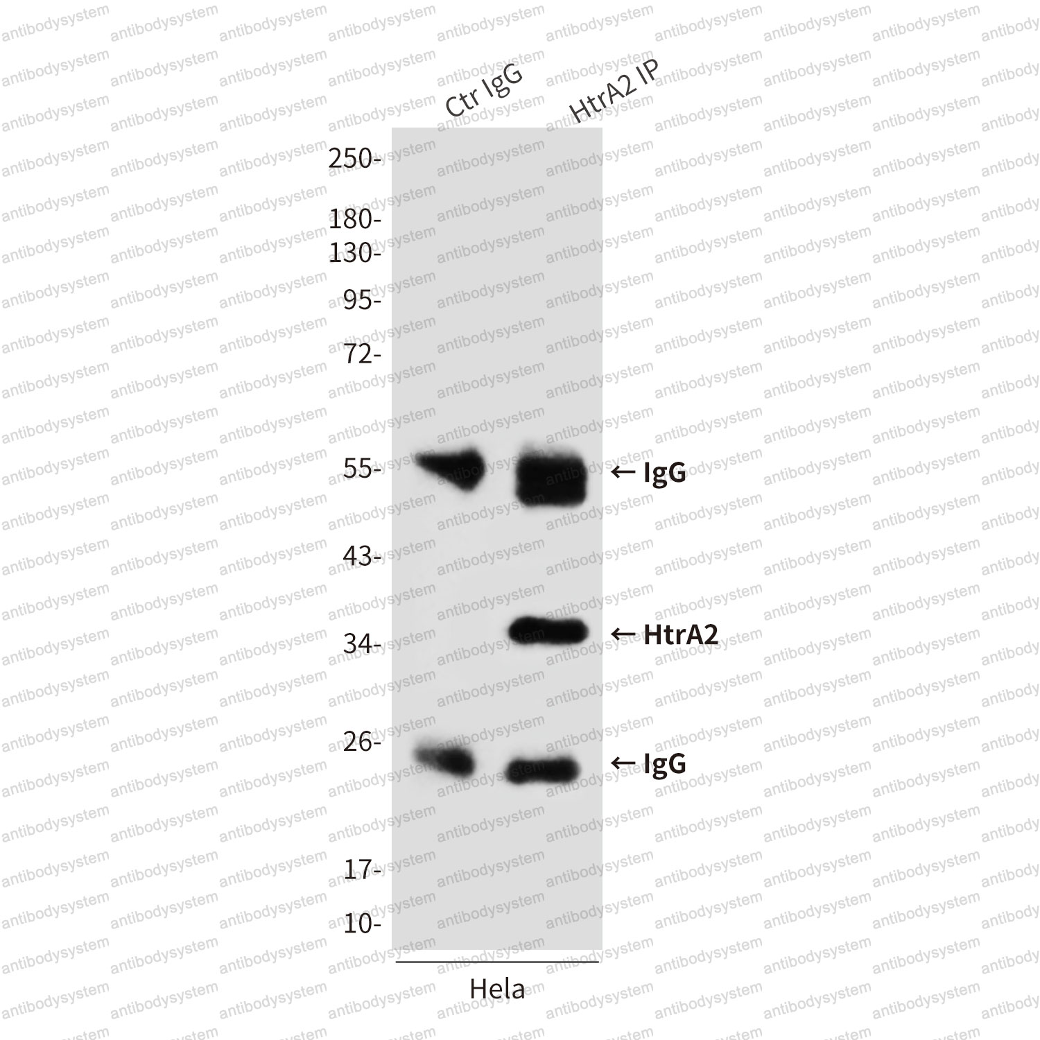 Anti-HTRA2 Antibody (R2U87)