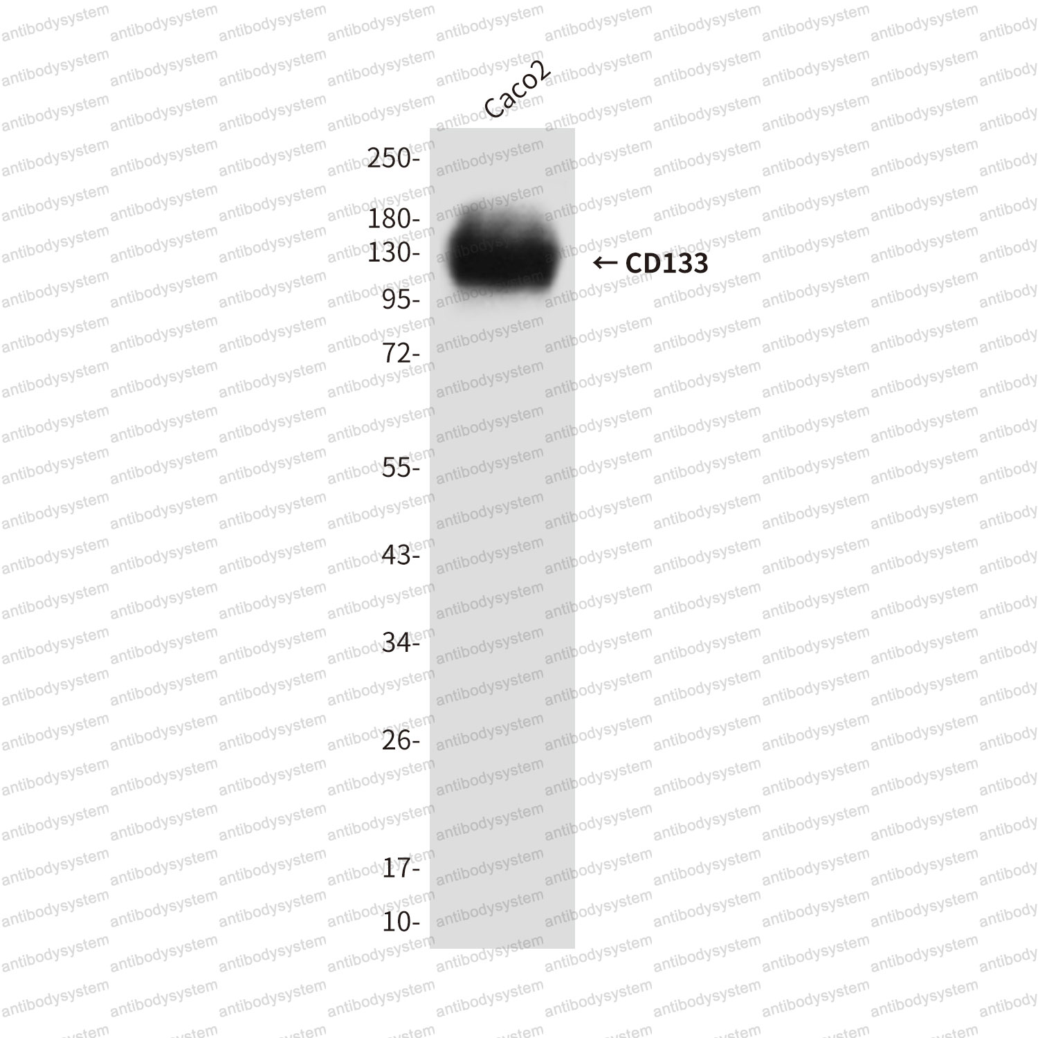 Anti-CD133/PROM1 Antibody (R2U91)