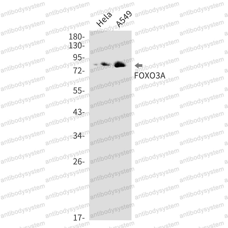 Anti-FOXO3 Antibody (R1E13)