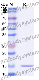 Anti-Human DCX Nanobody (SAA1021)