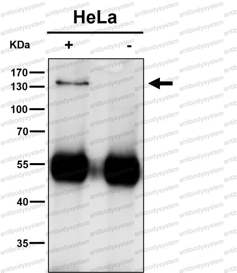 Anti-HTATSF1 Antibody (R1E31)