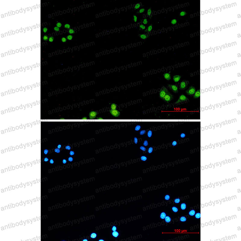 Anti-AKAP8 Antibody (R1E39)