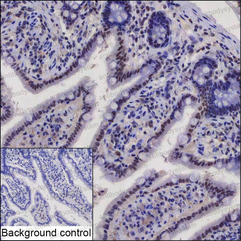 Anti-AKAP8 Antibody (R2V06)