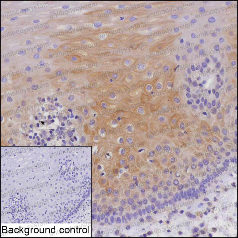 Anti-ANGPTL7 Antibody (R2V08)
