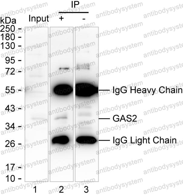 Anti-GAS2 Antibody (R2V11)