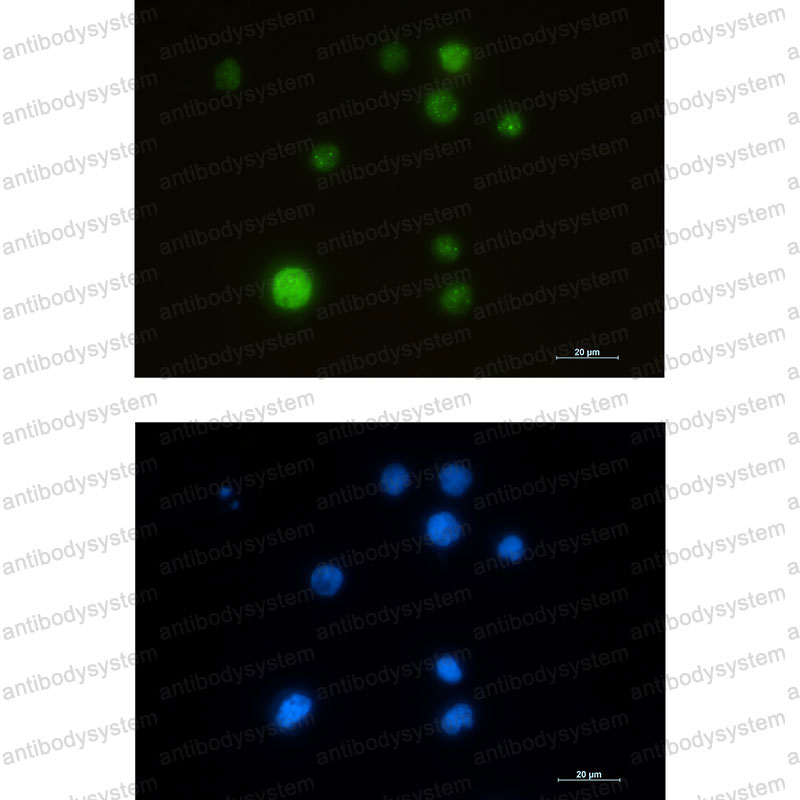 Anti-SMARCA5 Antibody (R1E50)