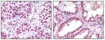Anti-KDM1A Antibody (R2V17)