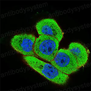 Anti-ONECUT3 Antibody (R2V24)