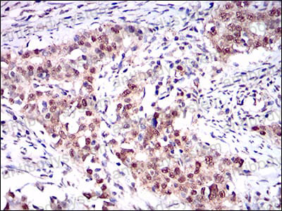 Anti-ONECUT3 Antibody (R2V25)