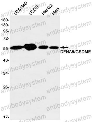 Anti-GSDME Antibody (R1E57)