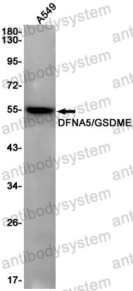 Anti-GSDME Antibody (R1E58)