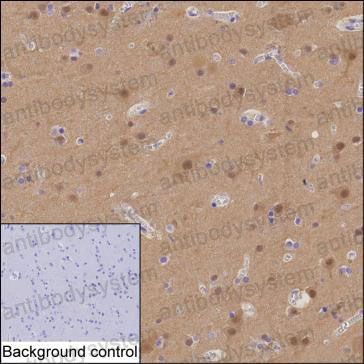 Anti-EVI5 Antibody (R2V26)
