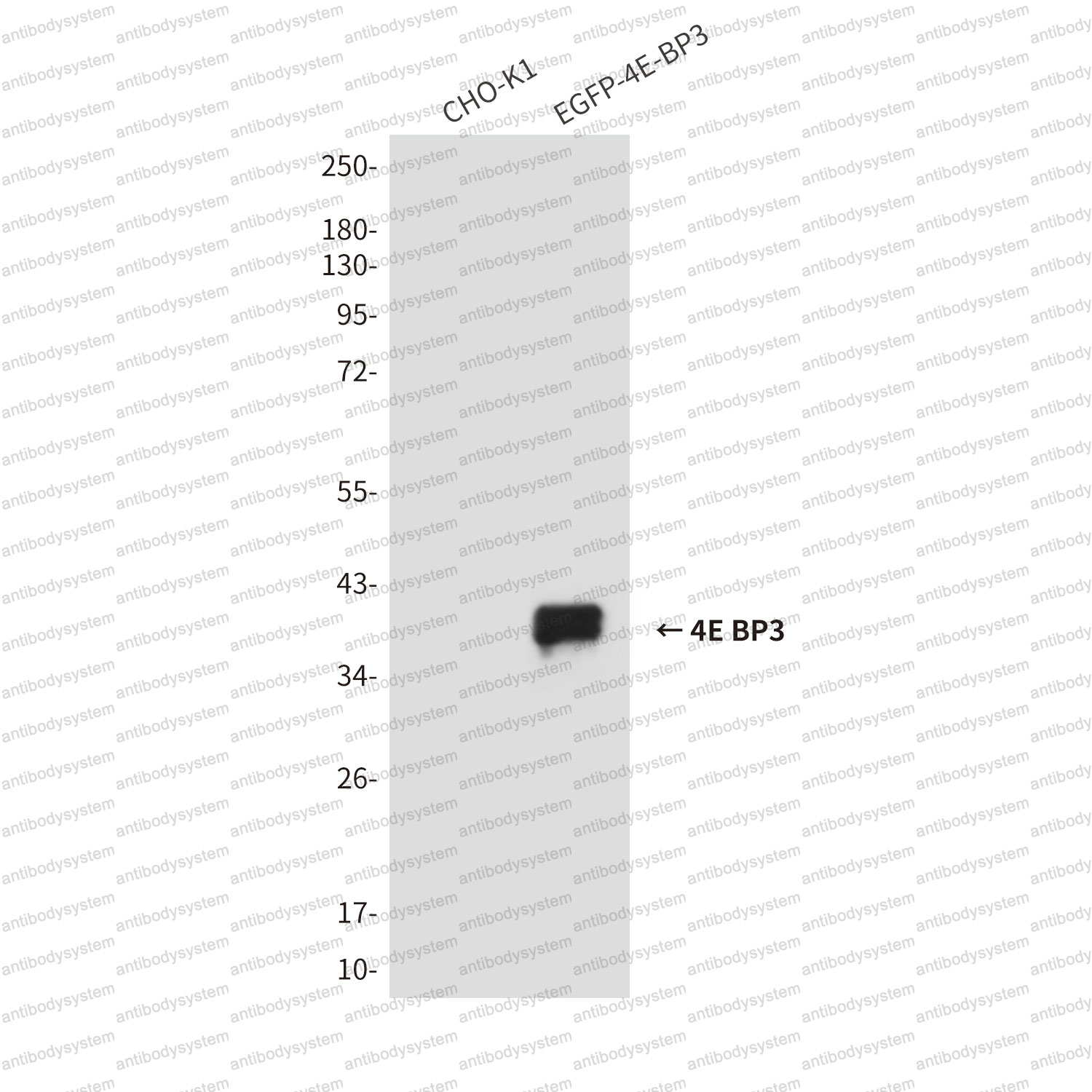 Anti-EIF4EBP3 Antibody (R2V30)