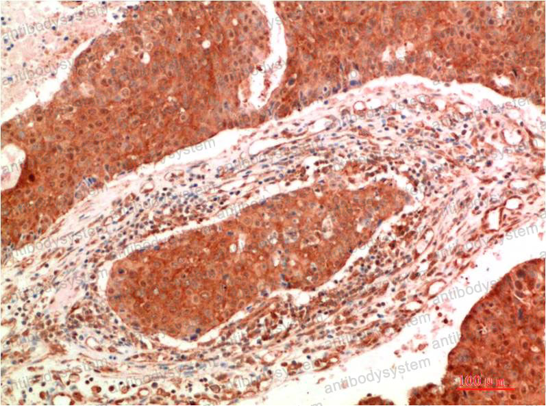 Anti-JAK2 Antibody (R2V36)