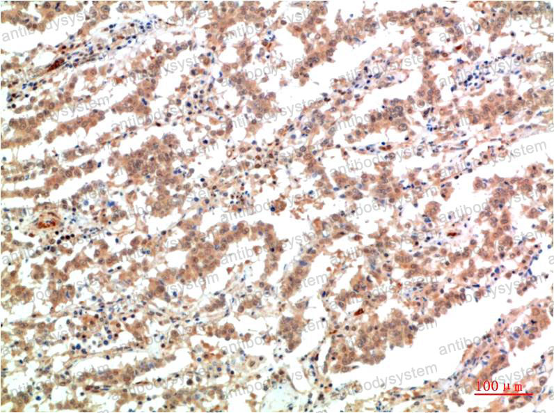 Anti-JAK2 Antibody (R2V37)