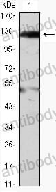 Anti-JAK2 Antibody (R2V34)