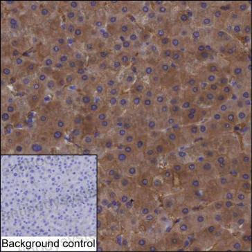 Anti-UGDH Antibody (R2V38)