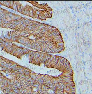 Anti-CTNND1 Antibody (R2V39)