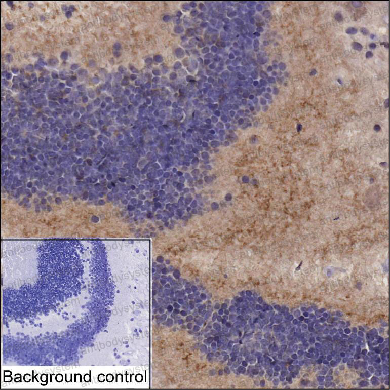 Anti-HCN1 Antibody (R2V40)