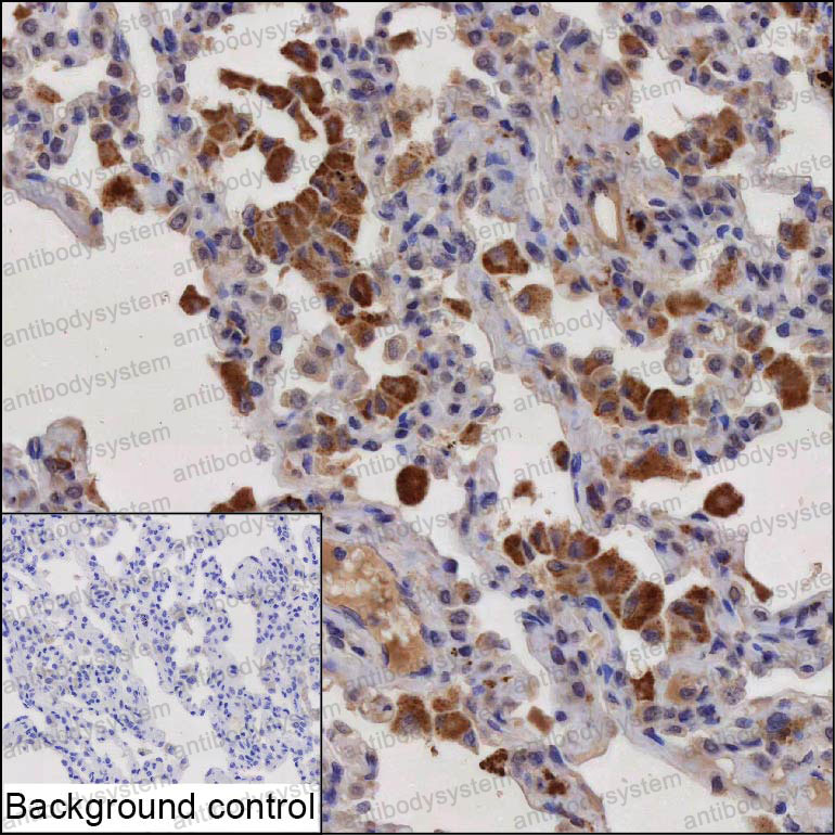 Anti-HPGDS Antibody (R2V41)