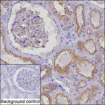 Anti-HIP1R Antibody (R2V56)