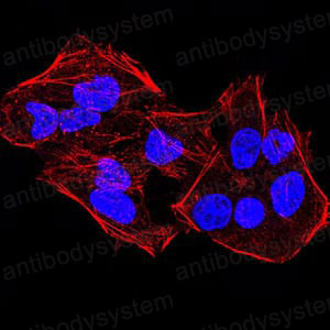 Anti-KDM4A Antibody (R2V58)