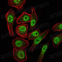 Anti-KDM4A Antibody (R2V57)