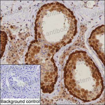 Anti-DNAJB6 Antibody (R2V59)