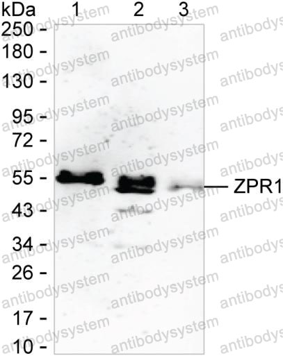 Anti-ZPR1 Antibody (R2V63)