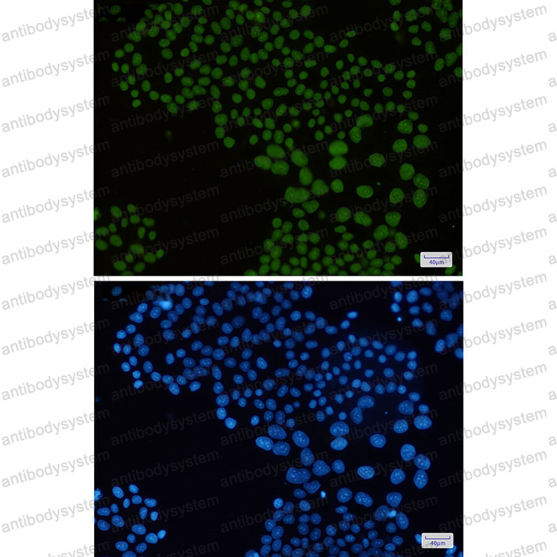 Anti-MACROH2A1 Antibody (R1F22)