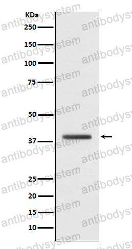 Anti-MACROH2A1 Antibody (R1F21)