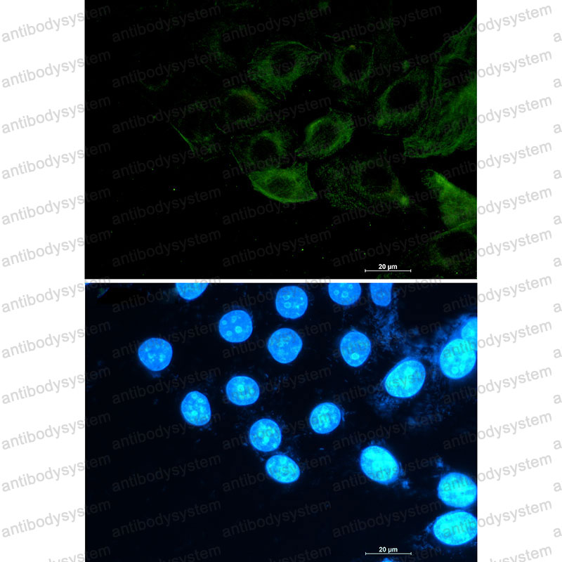 Anti-Phospho-Filamin A/B (Ser2152/Ser2107) Antibody (R1F23)