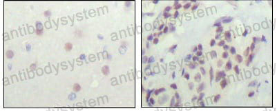 Anti-NCOR1 Antibody (R2V68)