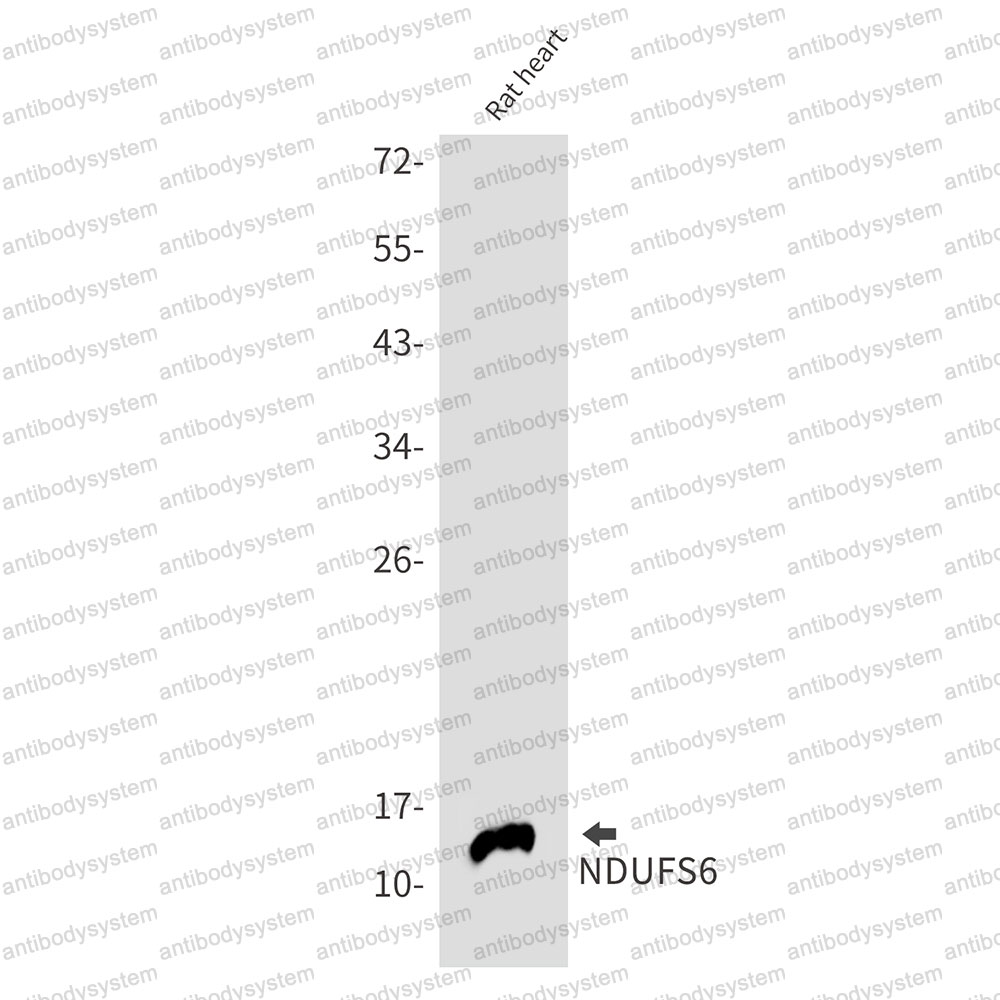 Anti-NDUFS6 Antibody (R1F24)