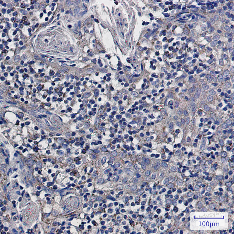 Anti-NDUFS6 Antibody (R1F25)