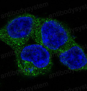 Anti-ULK1 Antibody (R1F26)