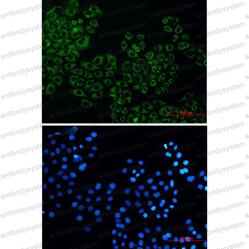 Anti-CS Antibody (R1F28)