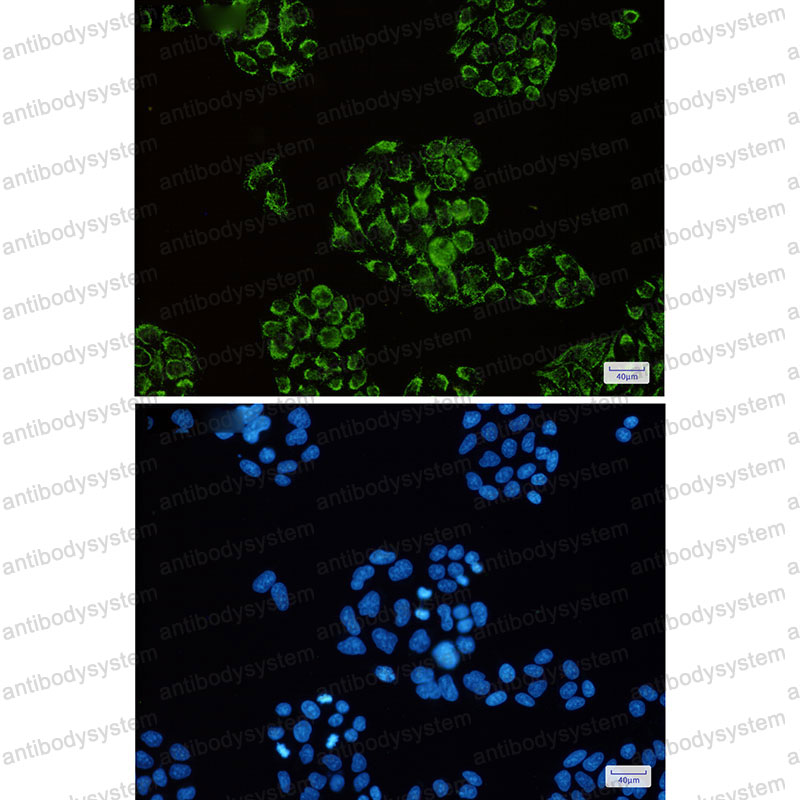 Anti-CS Antibody (R1F29)