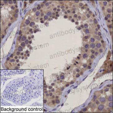 Anti-H2AP Antibody (R2V69)