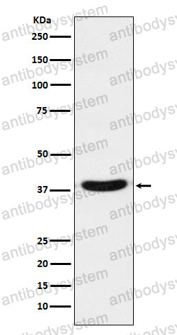 Anti-VPS26A Antibody (R1F31)