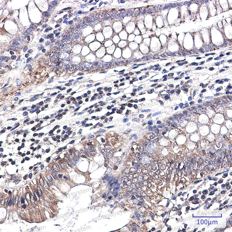 Anti-NDUFB1 Antibody (R1F32)