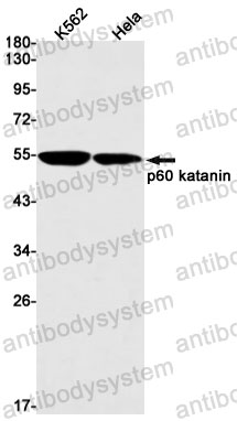 Anti-KATNA1/p60 Antibody (R1F35)