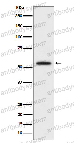 Anti-KATNA1 Antibody (R1F34)