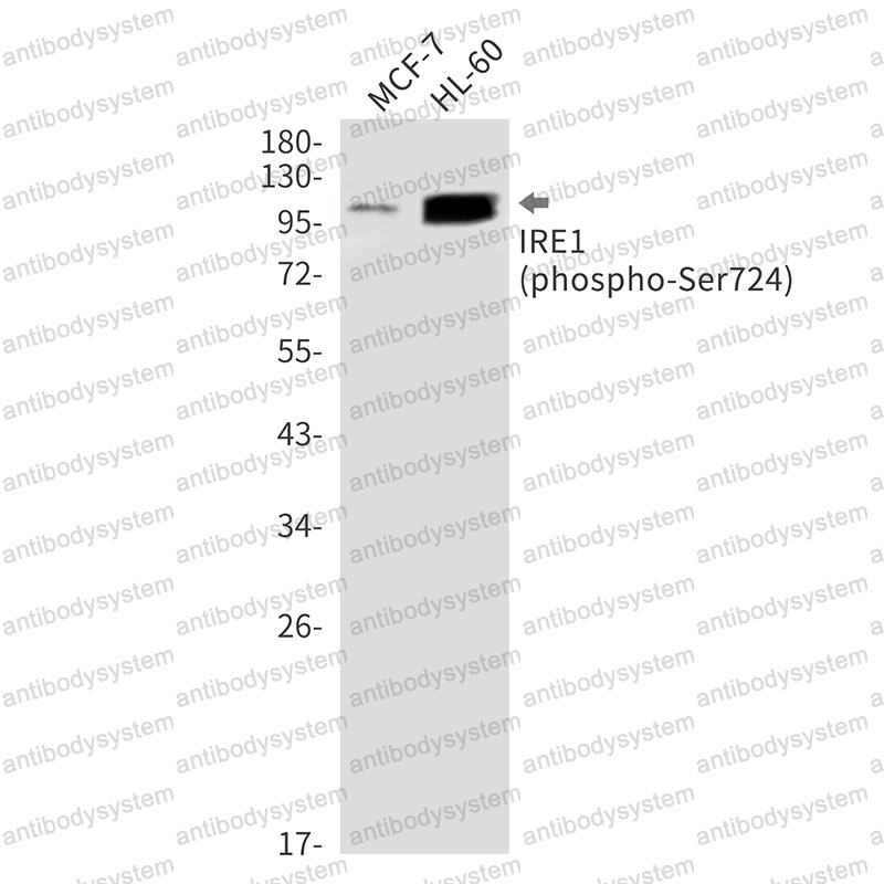 Anti-Phospho-IRE1 (Ser724) Antibody (R1F37)