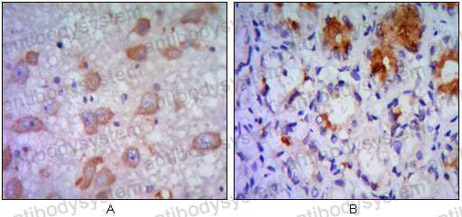 Anti-ERN1 Antibody (R2V70)